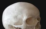 Age-related transformations of the skull Extreme stenosis of the head in a child