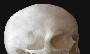 Свързани с възрастта трансформации на черепа Екстремна стеноза на главата при дете